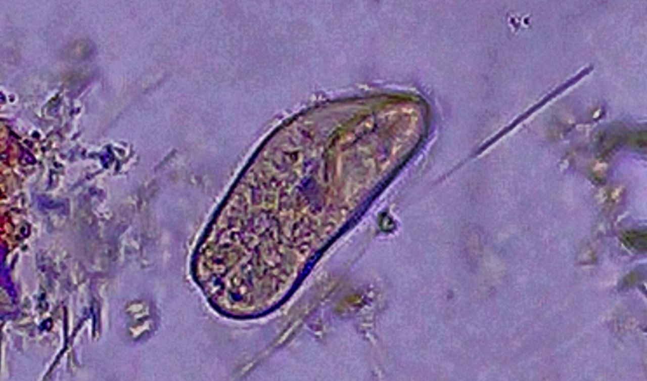 Il paramecio, il gigante dei Ciliati
